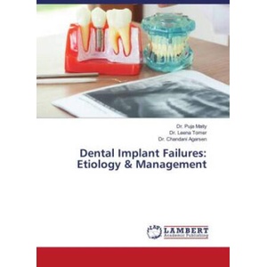 Dental Implant Failures: Etiology & Management | Leena Tomer, Chandani Agarsen (2023)