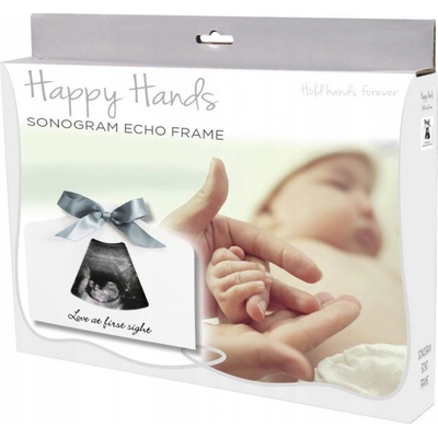 Happy Hands sonogram Echo Frame