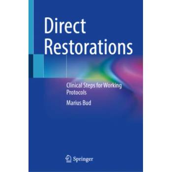 Direct Restorations | Marius Bud