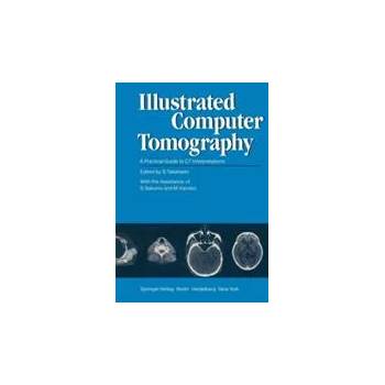 Image 1 of Illustrated Computer Tomography | M. Kaneko, S. Sakuma, S. Takahashi