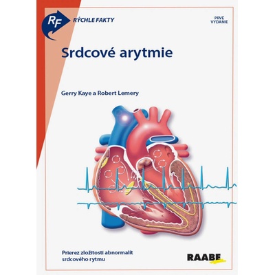 Srdcové arytmie