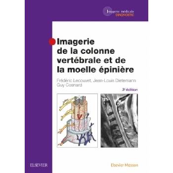 Imagerie de la colonne vertébrale et de la moelle épinière