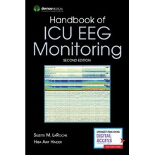 Handbook of ICU Eeg Monitoring Laroche SuzettePaperback