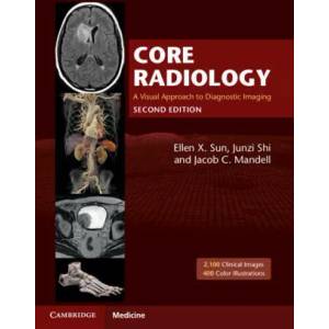 Core Radiology A Visual Approach to Diagnostic Imaging - Multiple copy pack (ISBN: 9781108965910)