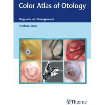 Color Atlas of Otology