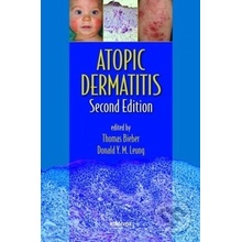 Atopic Dermatitis - Thomas Bieber, Donald Y. M. Leung