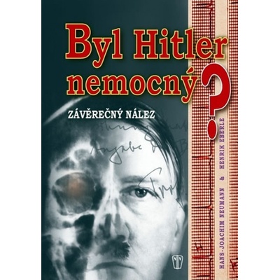 Byl Hitler nemocný?