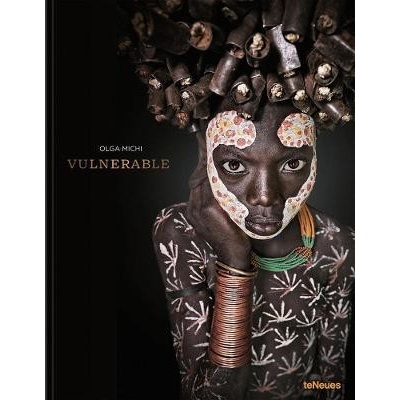 Vulnerable
