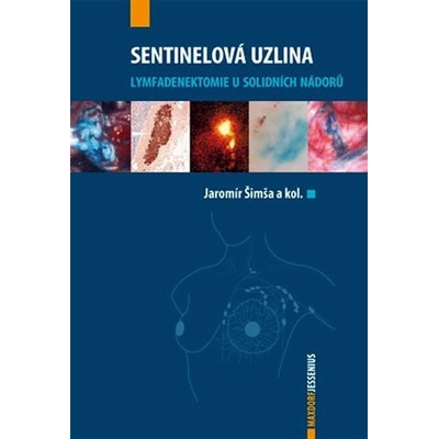 Sentinelová uzlina - Jaromír Šimša a kolektív