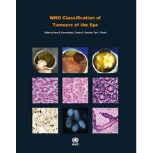 WHO Classification of Tumours of the Eye - World Health Organization