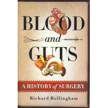 Blood and Guts: A History of Surgery