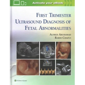 First Trimester Ultrasound Diagnosis of Fetal Abnormalities | Alfred Abuhamad, Rabih Chaoui (ISBN: 9781451193725)