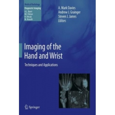 Imaging of the Hand and Wrist Davies A. MarkPevná vazba