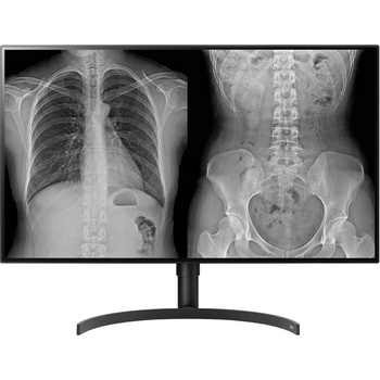 LG 32HL512D