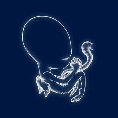 Sigur Ros - Agaetis Byrjun Vinyl LP
