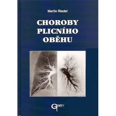Choroby plicního oběhu - Martin Riedel