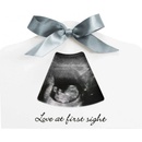 Happy Hands sonogram Echo Frame