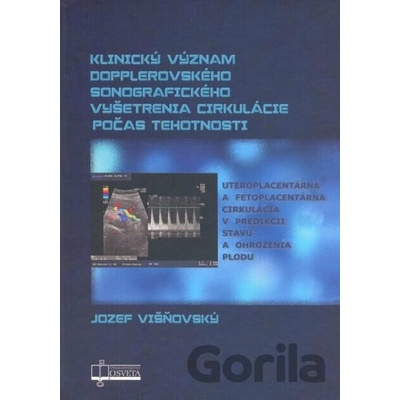 Klinický význam dopplerovského sonografického vyšetrenia cirkulácie počas tehotnosti Jozef Višňovský
