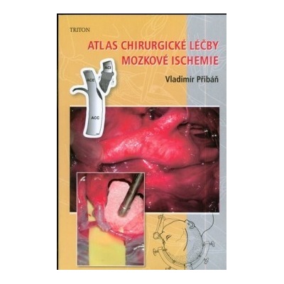 Atlas chirurgické léčby mozkové ischemie - Vladimír Přibáň