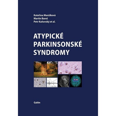 Atypické parkinsonské syndromy
