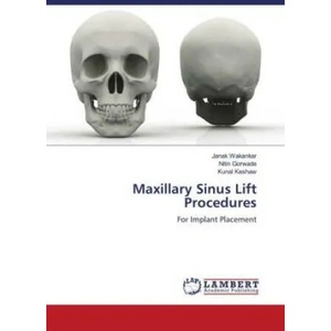 Maxillary Sinus Lift Procedures | Nitin Gorwade, Kunal Keshaw (ISBN: 9786204979946)