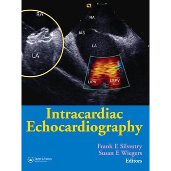 Intracardiac Echocardiography Silvestry Frank E.