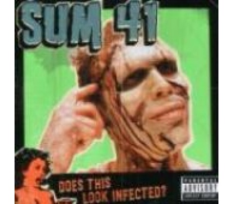 Sum 41 - Does This Look Infected?