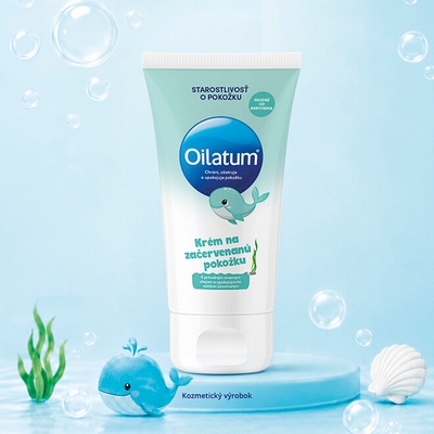 Oilatum krém na začervenanú pokožku 100 ml