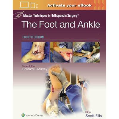 Master Techniques in Orthopaedic Surgery: The Foot and Ankle | SCOTT ELLIS