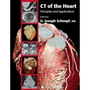 CT of the Heart | U. Joseph Schoepf (ISBN: 9781617374814)