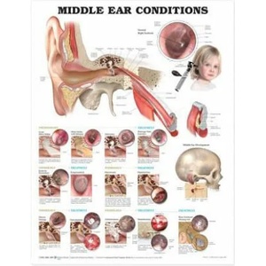 Middle Ear Conditions Anatomical Chart | Anatomical Chart Company (ISBN: 9781605470955)
