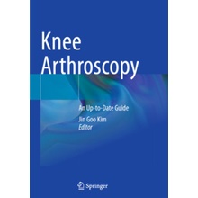 Knee Arthroscopy