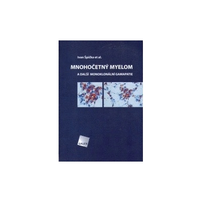 Mnohočetný myelom