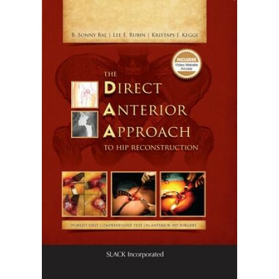 Direct Anterior Approach to Hip Reconstruction