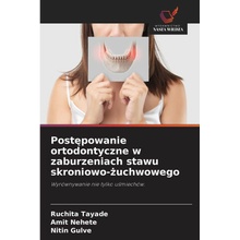 Postepowanie ortodontyczne w zaburzeniach stawu skroniowo-zuchwowego