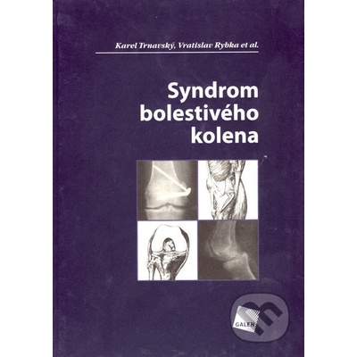 Syndrom bolestivého kolena - Karel Trnavský