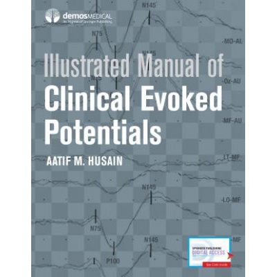 Illustrated Manual of Clinical Evoked Potentials