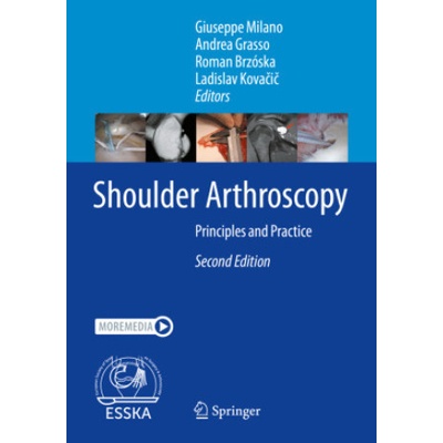 Shoulder Arthroscopy