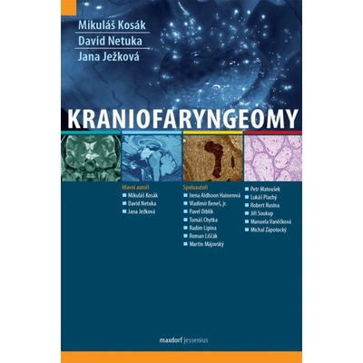 Kraniofaryngeomy - Mikuláš Kosák; David Netuka; Jana Ježková