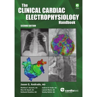 The Clinical Cardiac Electrophysiology Handbook, Second Edition (Andrade Jason G.)