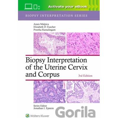 Biopsy Interpretation of the Uterine Cervix and Corpus: Print + eBook with Multimedia - ANAIS MALPICA, Preetha, MD Ramalingam, Preetha Raj Kannan, Elizabeth D. Euscher