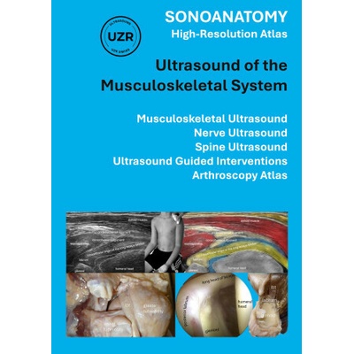 SONOANATOMY - High-Resolution Atlas - Ultrasound of the Musculoskeletal System