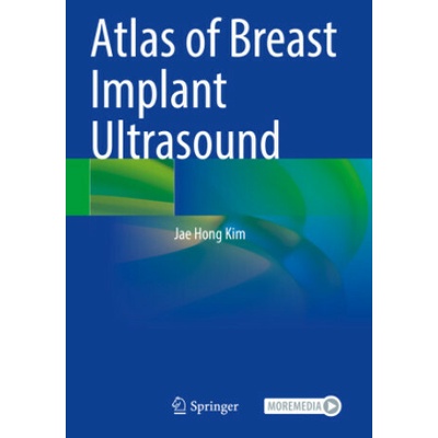 Atlas of Breast Implant Ultrasound