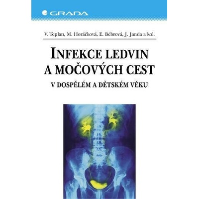 Infekce ledvin a močových cest - Vladimír Teplan, Miroslava Horáčková, Jan Janda, Eliška Bébrová – Hledejceny.cz