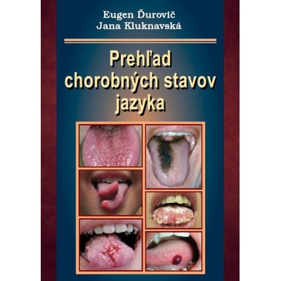 Prehľad chorobných stavov jazyka