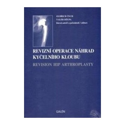 Revizní operace náhrad kyčelního kloubu