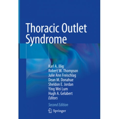Thoracic Outlet Syndrome