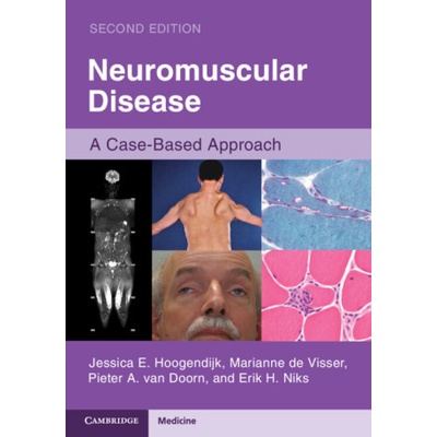 Neuromuscular Disease – Hledejceny.cz
