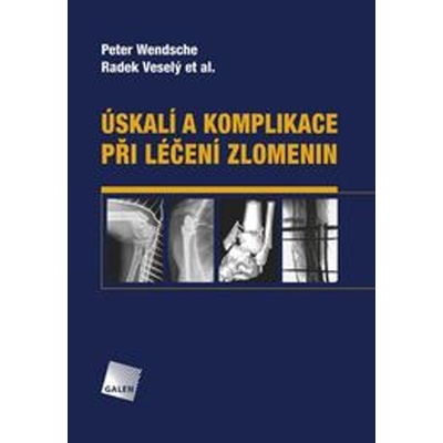 Úskalí a komplikace při léčení zlomenin - Radek Veselý