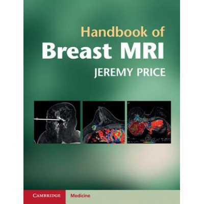 Handbook of Breast MRI